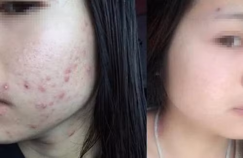 Mặt có những biểu hiện này, đi khám phụ khoa ngay Mat co nhung bieu hien nay, di kham phu khoa ngay