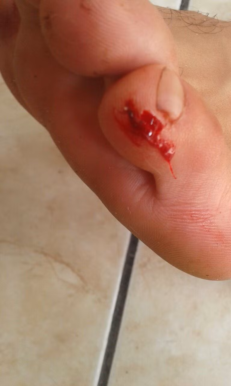 Ly giai hien tuong doi ma ca rong hut mau hang loat nguoi-Hinh-2