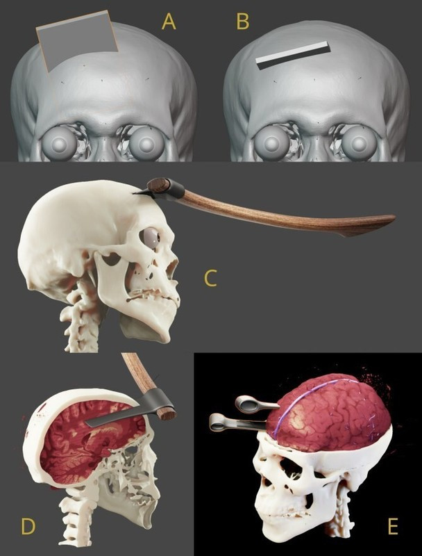 Cụ thể, vào những năm 1960, giới chuyên gia sử dụng tia X để kiểm tra xác ướp pharaoh Seqenenre Tao II. Theo đó, họ phát hiện nhiều vết thương trên mặt, đầu.