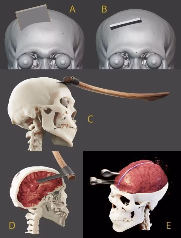 Cụ thể, vào những năm 1960, giới chuyên gia sử dụng tia X để kiểm tra xác ướp pharaoh Seqenenre Tao II. Theo đó, họ phát hiện nhiều vết thương trên mặt, đầu.