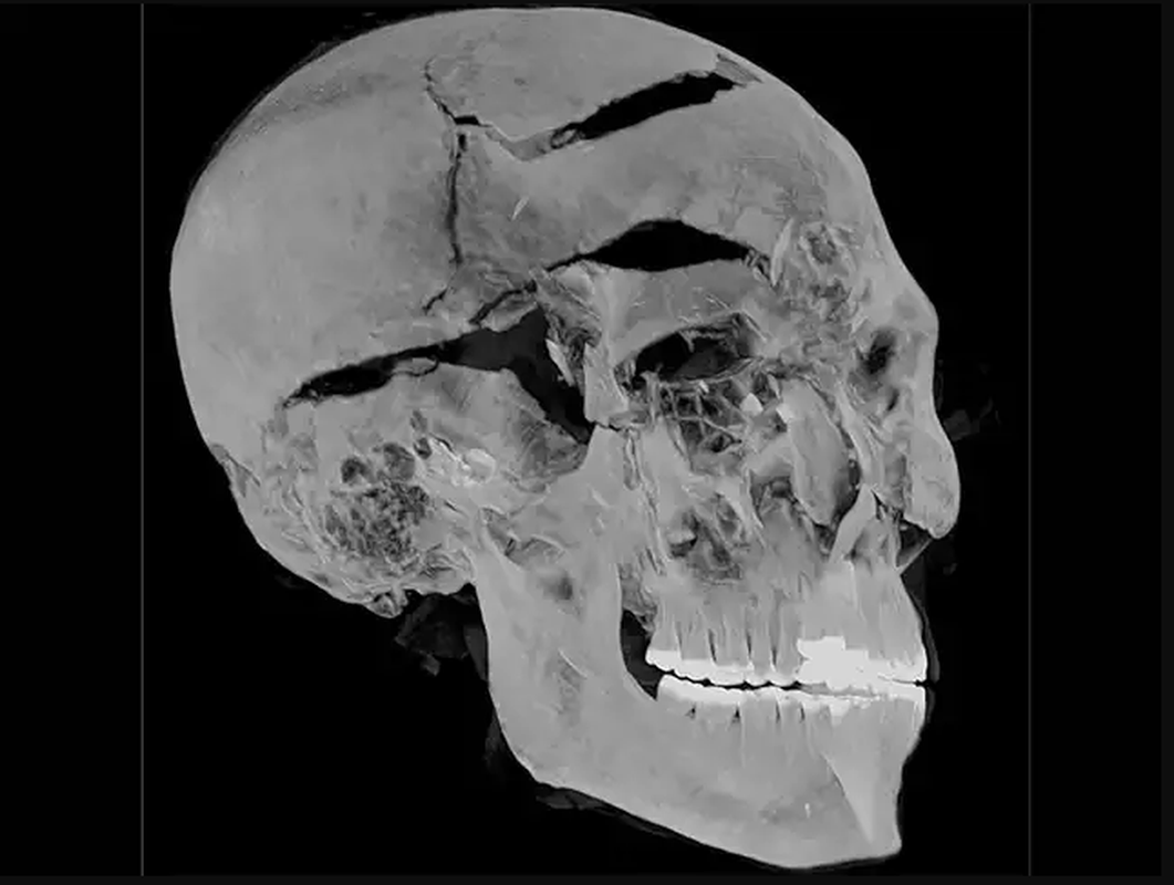 Nghiên cứu của các chuyên gia cũng chỉ ra pharaoh Seqenenre Tao II qua đời khi khoảng 40 tuổi.