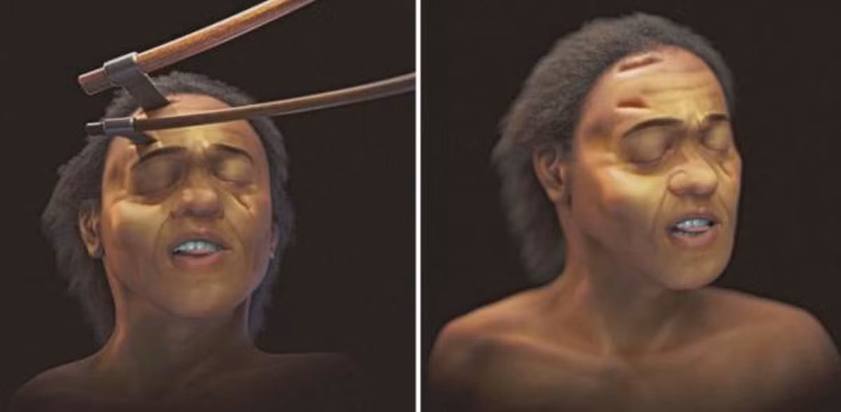 “Đôi tay biến dạng của xác ướp cho thấy pharaoh Seqenenre Tao II có thể đã bị bắt trên chiến trường và hai tay bị trói sau lưng. Vì vậy, nhà vua Ai Cập không thể tránh được cú tấn công chí mạng vào đầu", nhóm nghiên cứu cho biết.