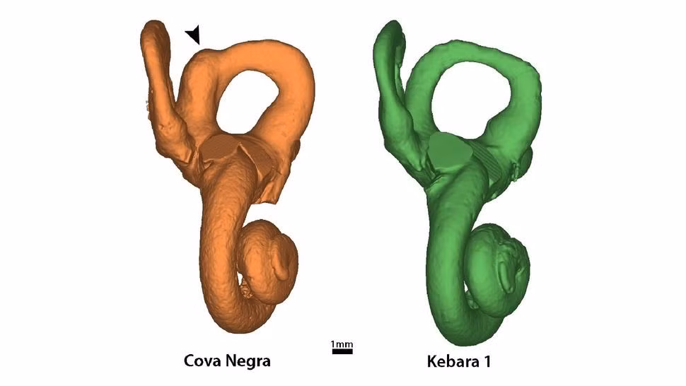 Theo kết quả nghiên cứu, đứa trẻ được đặt tên là Tina đã mắc hội chứng Down. Đây là trường hợp đầu tiên được biết đến mắc hội chứng Down ở người Neanderthal.
