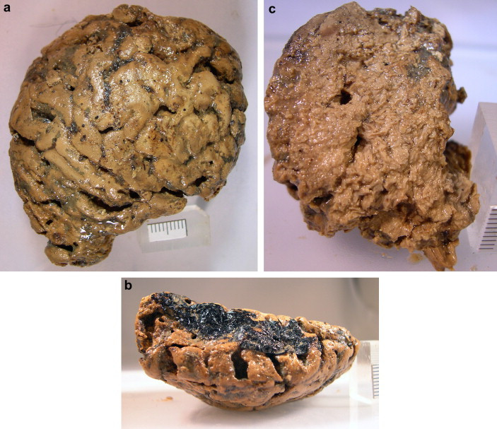 Các chuyên gia cho hay "bộ não Heslington" được bảo quản tốt như vậy là nhờ một chất chưa xác định đóng vai trò quan trọng trong việc bảo vệ các chất hữu cơ khỏi các enzyme phá hủy gọi là protease những tháng sau khi chết, cho phép các protein kết hợp thành các tập hợp ổn định có thể tồn tại ở nhiệt độ ấm hơn.