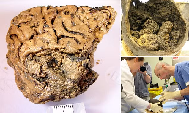 Các chuyên gia cho hay sẽ thực hiện các nghiên cứu khác nhằm sớm làm sáng tỏ hợp chất bí ẩn giúp bảo quản vẹn nguyên "bộ não Heslington" là gì.