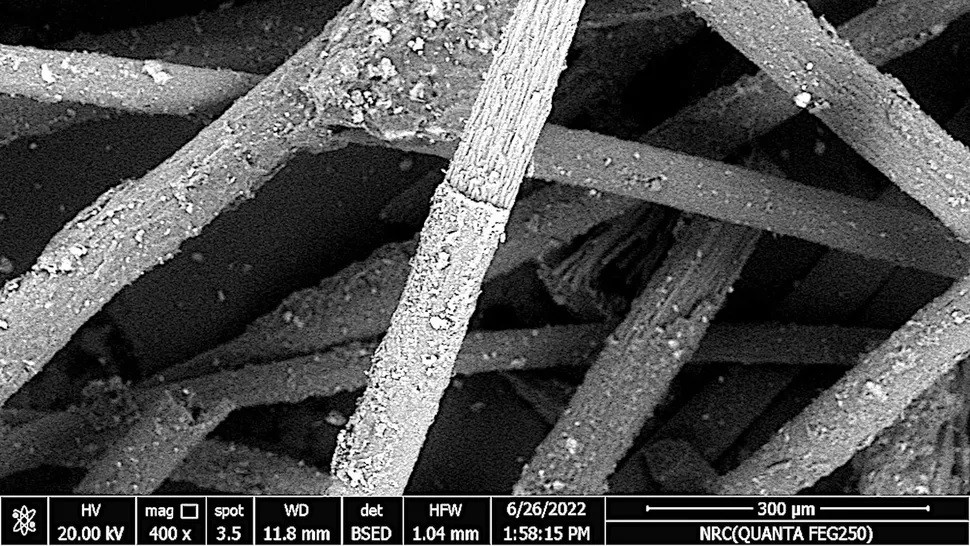 Điều khiến chuyên gia chú ý là biểu cảm gương mặt đáng sợ của người phụ nữ với đôi mắt như trợn ngược, miệng há ngoác. Điều này khiến nhiều người cảm thấy bà có cái chết đầy đau đớn.