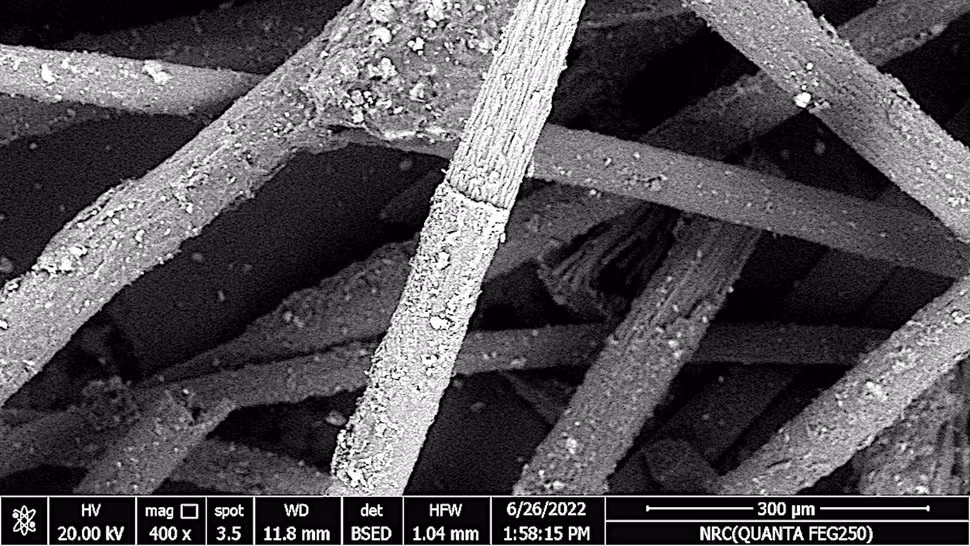 Điều khiến chuyên gia chú ý là biểu cảm gương mặt đáng sợ của người phụ nữ với đôi mắt như trợn ngược, miệng há ngoác. Điều này khiến nhiều người cảm thấy bà có cái chết đầy đau đớn.
