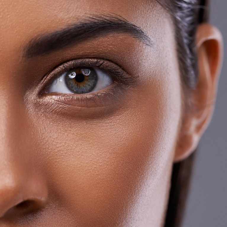  5. Cấu trúc xương Một số người có khuynh hướng di truyền hình thành các quầng thâm dưới mắt. Đó là do cấu tạo đường viền sọ và cách làn da cùng chất béo bên dưới tương tác với nó. Một số người có hốc mắt sâu, và cấu trúc xương đó tạo bóng làm tối vùng da quanh mắt. Trang điểm làm sáng và nổi bật vùng mắt có thể giúp khắc phục vấn đề.