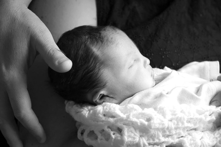 7. Hội chứng Edward (tam thể 18): Đây cũng là một dị tật bẩm sinh nặng gây sẩy thai, chết sau sinh. Rất ít trẻ mắc hội chứng Edward sống quá một tuổi. Dị tật bẩm sinh về tim, đầu nhỏ, thoát vị rốn rất hay gặp, trí tuệ và vận động đếu rất kém phát triển. Nếu sống sót, trẻ mắc hội chứng tam thể 18 cũng không có khả năng đi lại, nói, do đó phụ thuộc hoàn toàn vào sự chăm sóc của người khác.