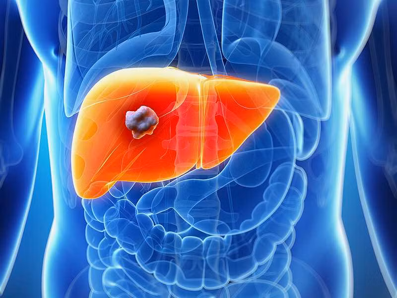 5 benh ung thu nguoi Viet Nam mac phai nhieu nhat hien nay-Hinh-3