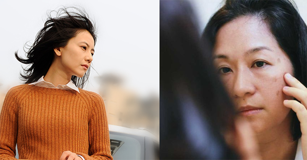 Đáng lưu ý, collagen là một loại protein có trong cấu trúc của da, tóc, móng tay, xương và khớp. Collagen chiếm 30% tổng số các loại protein trong cơ thể. Nó không chỉ giúp đem lại độ đàn hồi cho làn da, mà còn đóng vai trò quan trọng đối với sức khỏe của xương khớp. Thậm chí, một số loại collagen còn có tác dụng tạo lớp màng bảo vệ các bộ phận nội tạng, chẳng hạn như thận.