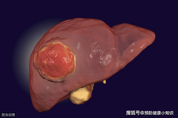 35 tuoi ung thu gan, giat minh nguyen nhan tu thoi quen pho bien