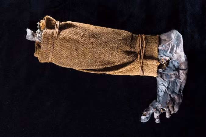 Một cái chân được tìm thấy trong đầm lầy vào năm 1944. Các bộ phận của cơ thể vô tình được bảo quản trong đầm lầy thường được tìm thấy bởi nông dân.