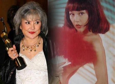 Khuôn mặt "bom sex" xinh đẹp một thời biến dạng vì phẫu thuật thẩm mỹ.