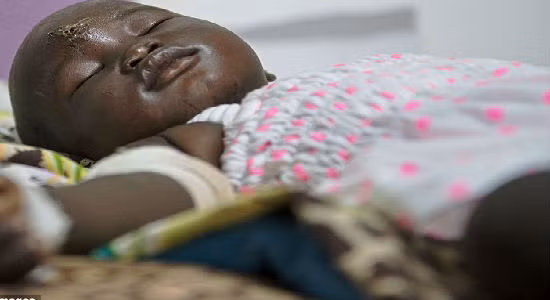 Bé Nyalou đang được các y tá và cha của bé là anh Thong Deng chăm sóc trong bệnh viện. Anh Thong Deng đã bay tới Juba từ Paloich sau khi nghe tin về vụ tai nạn.