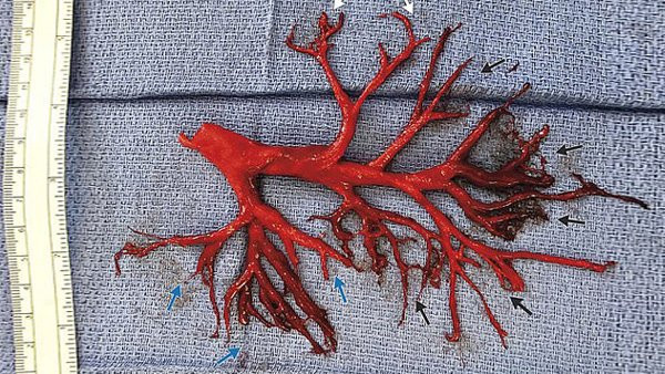 Hy huu nguoi dan ong ho ra ca 'cay phe quan' roi qua doi