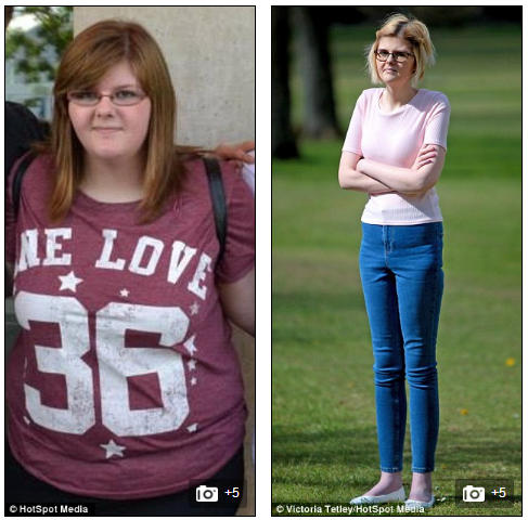 Trong ba tháng, trọng lượng của Kirsty Watson (20 tuổi) giảm gần 65kg trong vì mắc chứng Crohn - một bệnh viêm ruột. Miêu tả về triệu chứng của mình, Kristy cho biết "Đó là một điều đáng sợ. Mỗi lần cố gắng ăn cái gì đó, tôi đều buồn nôn. Nó khủng khiếp đến mức, tôi chỉ làm ăn một bữa mỗi ngày". Sau ba tháng, Kristin mất đi một nửa trọng lượng cơ thể. Cô gày đến mức xương nhô ra và da chuyển sang màu xám. 