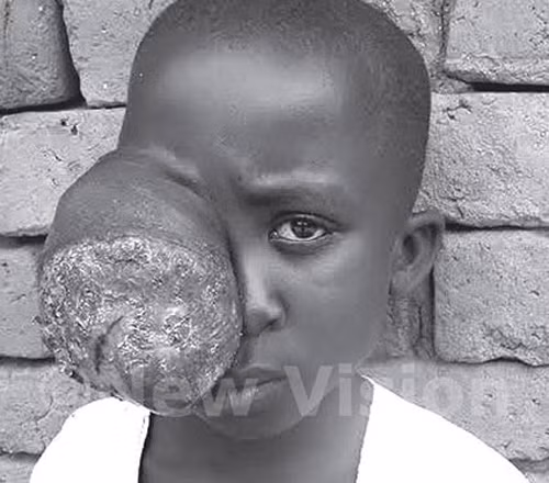 Khối u lở loét khiến cuộc sống của Gloria như rơi xuống địa ngực. Hiện cô bé chỉ biết chịu đựng đau đớn và chờ chết.