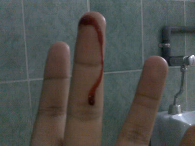 Yêu qua cửa sau có thể khiến họ toát mồ hôi, rùng mình và thậm chí là đau rát, chảy máu. Nếu bạn không cẩn thận và làm quá nhanh thì cô ấy rất dễ bị đau. Khi đó bạn khó có cơ hội để “yêu” qua cửa sau lần thứ hai với người bạn đời của mình.