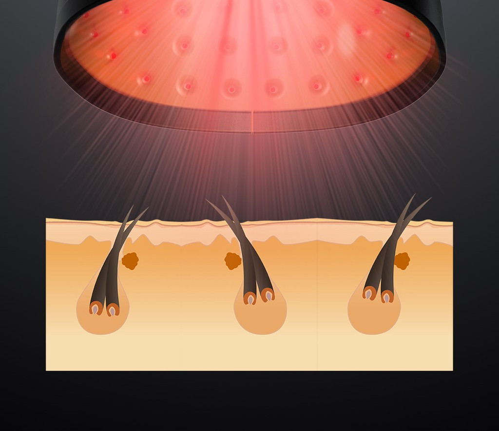 Xiaomi ra mat mu moc toc cho nguoi hoi, gia 211 USD-Hinh-3