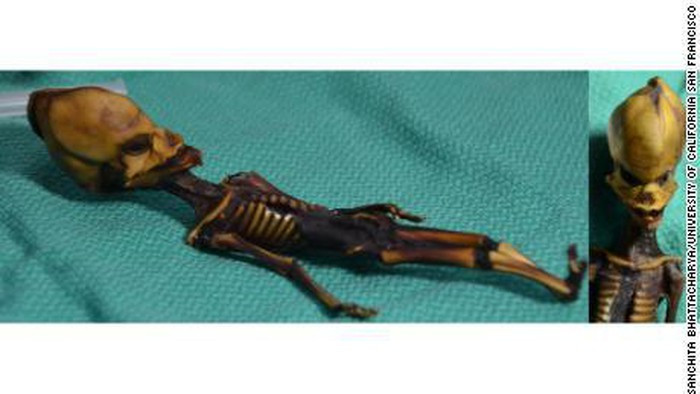 Dù vậy, các chuyên gia, nhà khoa học vẫn chưa thể lý giải được bộ xương kỳ lạ này có thực sự thuộc về người tí hon hay không. video: Nghị lực của "thầy giáo tí hon" (nguồn: VTC14)