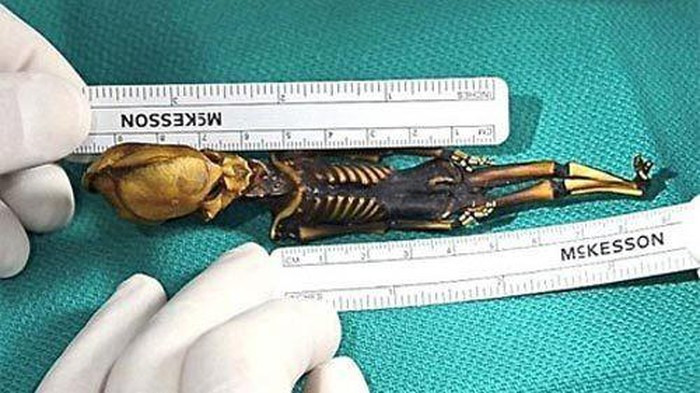 Kết quả kiểm tra của các chuyên gia cho thấy bộ hài cốt tí hon này chỉ có 10 xương sườn trong khi người khỏe mạnh bình thường có 12 xương sườn.