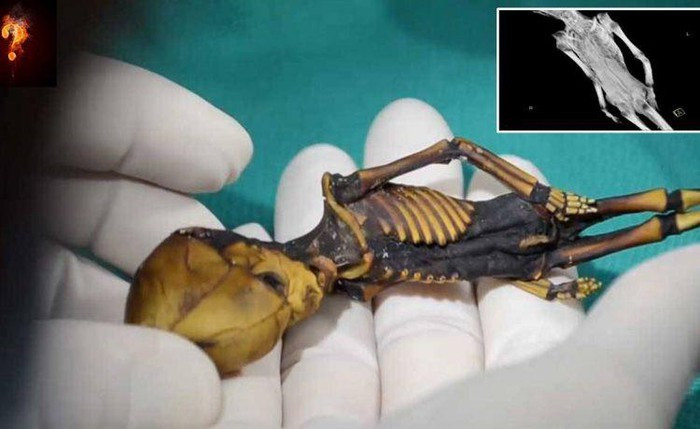 Bộ xương hình người chỉ cao 15 cm có bộ não bị biến dạng khi có hình nón khá đặc biệt.