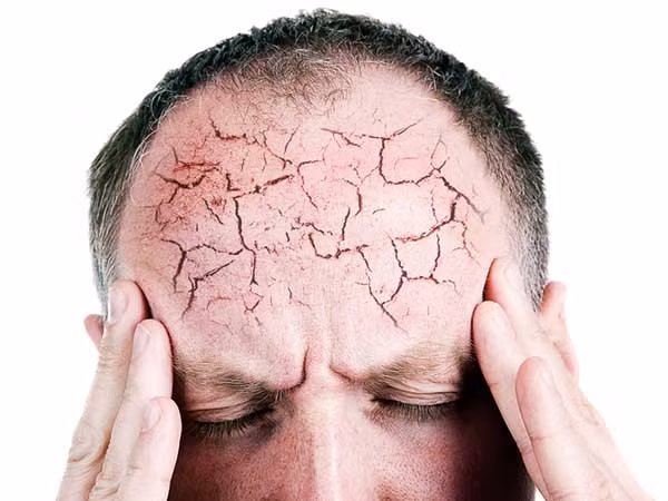 Sự gián đoạn giấc ngủ, mất ngủ không những ảnh hưởng nghiêm trọng đến sức khỏe mà còn khiến bạn mất tập trung trong mọi vấn đề vào ngày hôm sau.