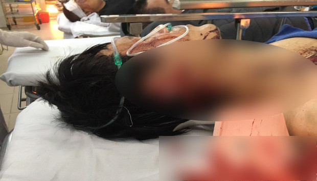  Rút dao chém thẳng vào cổ tài xế taxi để cướp tài sản: Tối 15/1, anh Đ.V.H. (38 tuổi, trú tại huyện Văn Lâm, tỉnh Hưng Yên) được Vũ Hoàng Huân (24 tuổi, huyện Ân Thi, tỉnh Hưng Yên) thuê chở bằng ô tô từ nhà lên Hà Nội. Khi đến quận Cầu Giấy, Huân bảo dừng xe và thanh toán tiền. Trong lúc chờ nhận tiền, tài xế taxi bị Huân chém một phát vào cổ bên phải. Hai bên giằng co, anh H. liên tục hô "cướp" khiến đối tượng sợ, tẩu thoát.