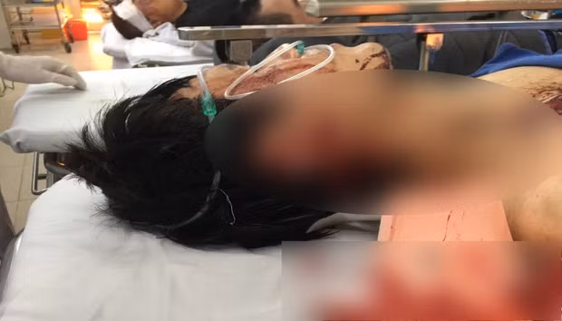  Rút dao chém thẳng vào cổ tài xế taxi để cướp tài sản: Tối 15/1, anh Đ.V.H. (38 tuổi, trú tại huyện Văn Lâm, tỉnh Hưng Yên) được Vũ Hoàng Huân (24 tuổi, huyện Ân Thi, tỉnh Hưng Yên) thuê chở bằng ô tô từ nhà lên Hà Nội. Khi đến quận Cầu Giấy, Huân bảo dừng xe và thanh toán tiền. Trong lúc chờ nhận tiền, tài xế taxi bị Huân chém một phát vào cổ bên phải. Hai bên giằng co, anh H. liên tục hô "cướp" khiến đối tượng sợ, tẩu thoát.