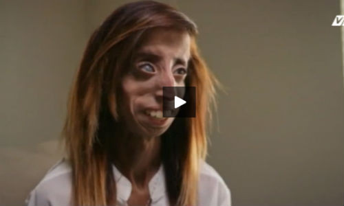 Nghi luc phi thuong cua nguoi phu nu xau nhat the gioi