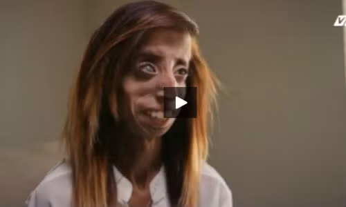 Nghi luc phi thuong cua nguoi phu nu xau nhat the gioi