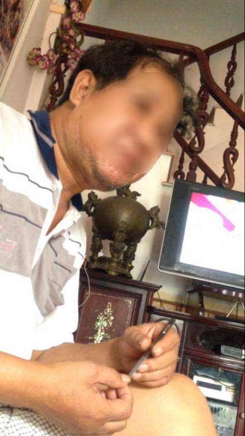 Ông L.V.C. thôn Đông Mai trước kia từng làm tái chế bình ắc quy giờ đây đã thấy hối hận vì chất độc của nó gây ra cho con mình.