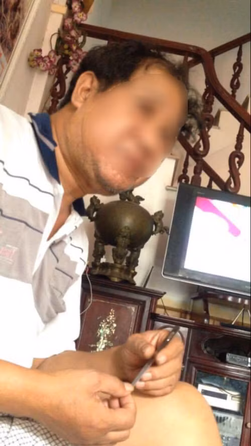 Ông L.V.C. thôn Đông Mai trước kia từng làm tái chế bình ắc quy giờ đây đã thấy hối hận vì chất độc của nó gây ra cho con mình.