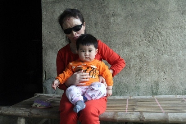 Cho đến thời điểm hiện tại, những kẻ tạt axit vẫn đang nhởn nhơ ngoài vòng pháp luật.