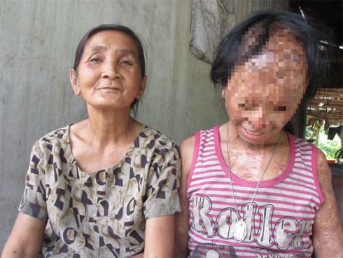 Bà nội Nhi cho biết vì hoàn cảnh khó khăn, bố của Nhi phải đi làm thuê ở xa, lâu mới về thăm nhà một lần khiến mẹ Nhi nảy sinh tình cảm với một người đàn ông tên K. trong vùng. Người này là chồng của đối tượng Nguyễn Thị Ngọc Linh (34 tuổi, ngụ cùng xã) - kẻ tạt axit. 