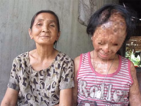 Bà nội Nhi cho biết vì hoàn cảnh khó khăn, bố của Nhi phải đi làm thuê ở xa, lâu mới về thăm nhà một lần khiến mẹ Nhi nảy sinh tình cảm với một người đàn ông tên K. trong vùng. Người này là chồng của đối tượng Nguyễn Thị Ngọc Linh (34 tuổi, ngụ cùng xã) - kẻ tạt axit. 