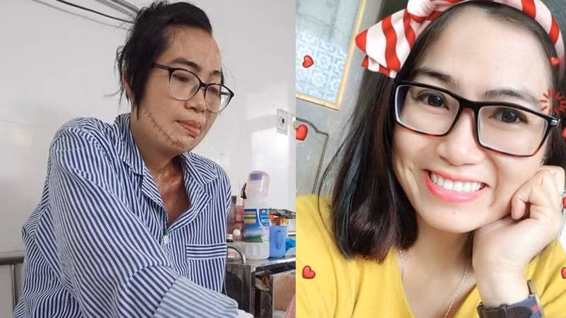  4. Cô giáo bị chồng cũ tạt axit: Năm 2018, Đặng Thị Thanh Huyền (34 tuổi, trú tại Gia Lâm, Hà Nội) và Phạm Văn Thông (36 tuổi) đã hoàn tất thủ tục ly hôn. Tuy nhiên, dịp Tết Nguyên đán, Phạm Văn Thông qua nhà xin lỗi bố mẹ vợ, năn nỉ Huyền quay về chung sống, dù thủ tục ly hôn đã hoàn tất.