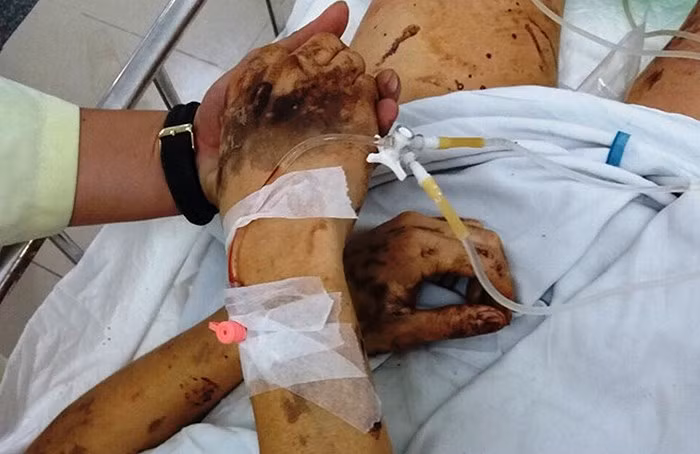 Ngày 6/5, CA tỉnh Quảng Ngãi phát đi thông báo nhận dạng 2 nghi phạm: đều là nam giới cao khoảng 1,6 m, nói giọng bắc, tuổi từ 20 đến 30 tuổi. đội mũ lưỡi trai, mặc áo khoác dài tay, quần jeans, dùng xe Wave xanh, cầm bình thủy tinh đựng axit Sunfuric và một dao bầu dài khoảng 30 cm.