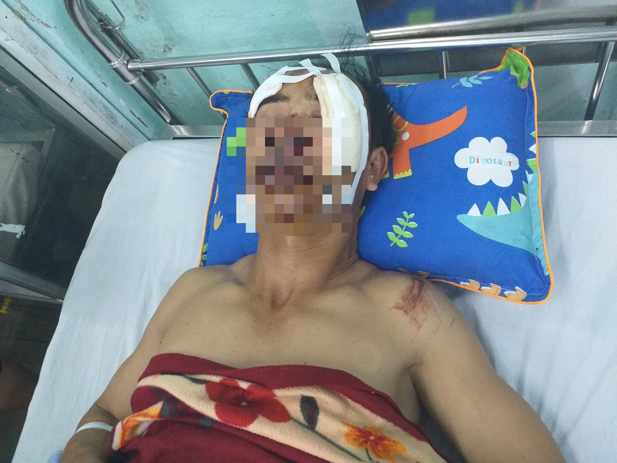 Nan nhan xe bien xanh gay tai nan: Chi mong bo tinh lai