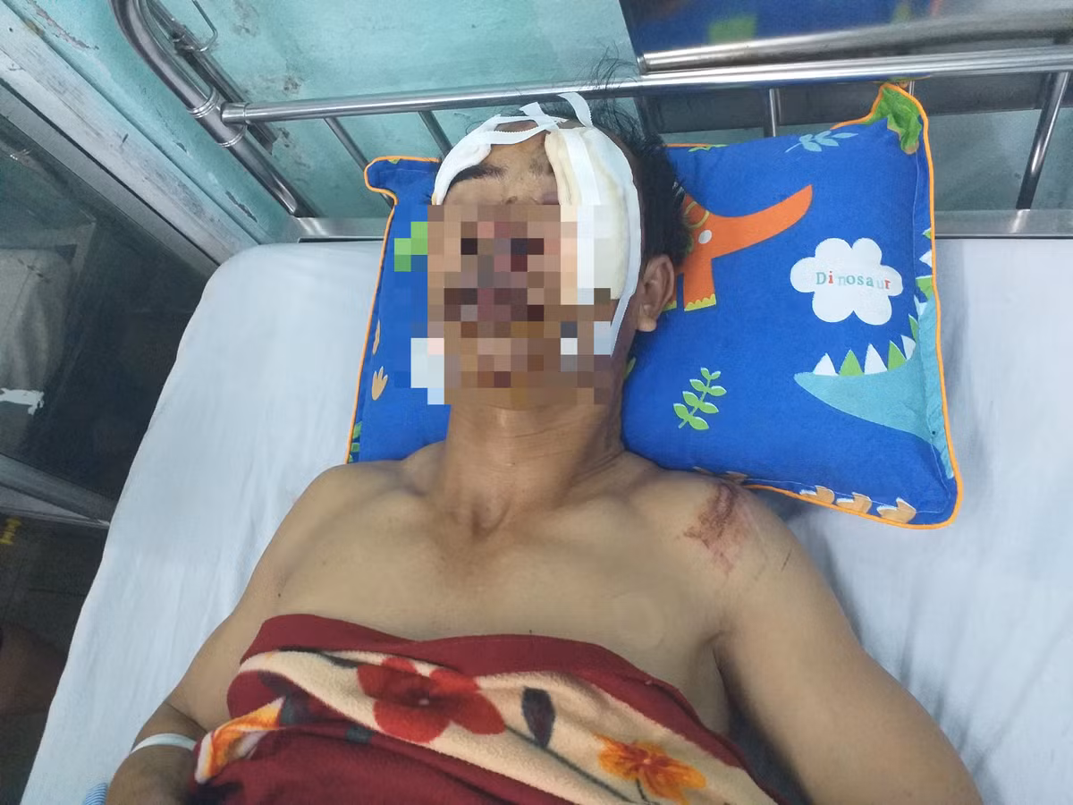 Nan nhan xe bien xanh gay tai nan: Chi mong bo tinh lai