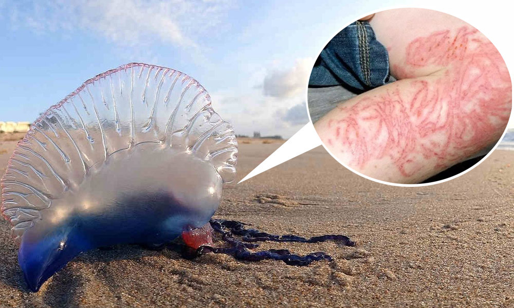 Du khach chet duoi o khu tam bien Dat Lanh: Lam the nao de an toan tinh mang?-Hinh-6