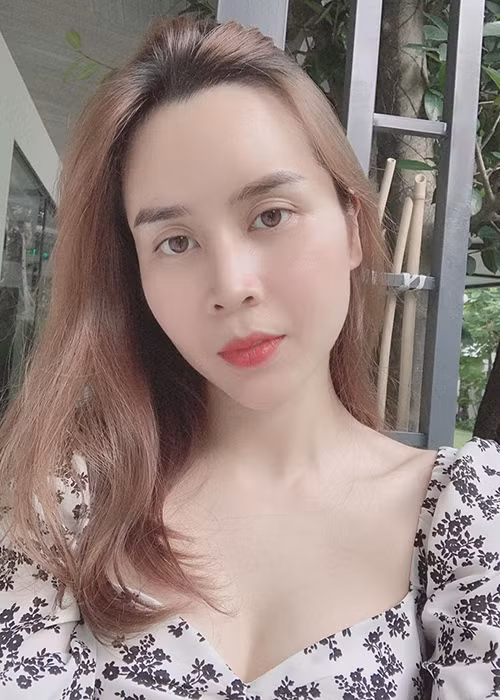 Tuy nhiên, một số cư dân mạng cho rằng ngoài mũi, nữ ca sĩ còn độn cằm.