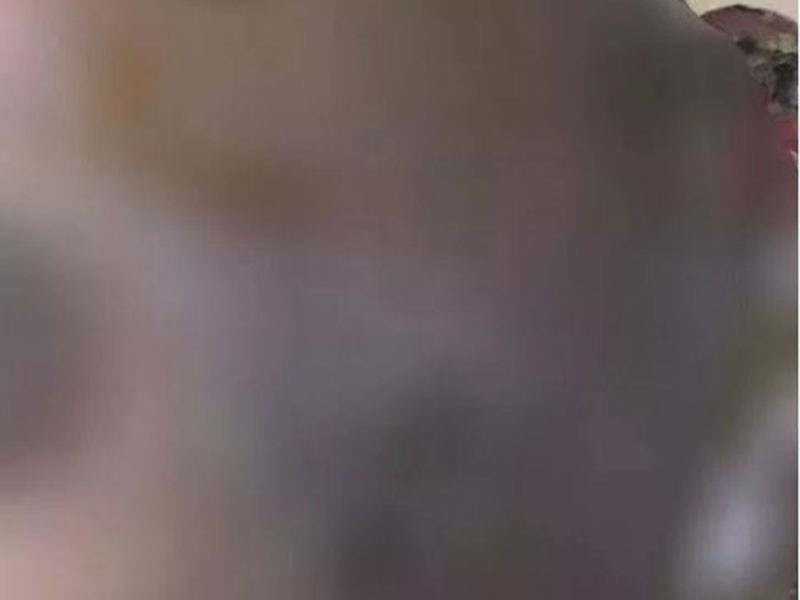 Chi vi ca tin, bau nguc 1 phu nu o Vinh Long bien dang dang so