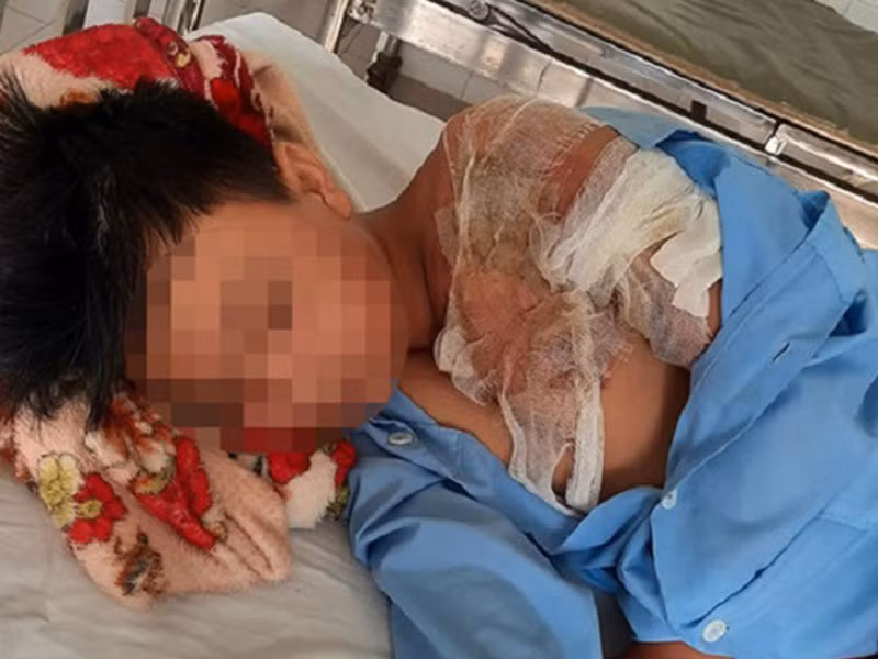 Cha tat nuoc soi khien con trai bi bong nang: CA Thanh Hoa vao cuoc