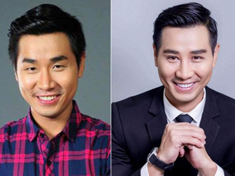 Nguyên Khang từng gây ồn ào vì nghi vấn dao kéo. Trước đây, anh có đôi mắt híp, đầu mũi hơi thô thế nhưng nam MC giờ có hai mí rõ ràng và mũi thon, gọn. Ảnh: Ngôi sao