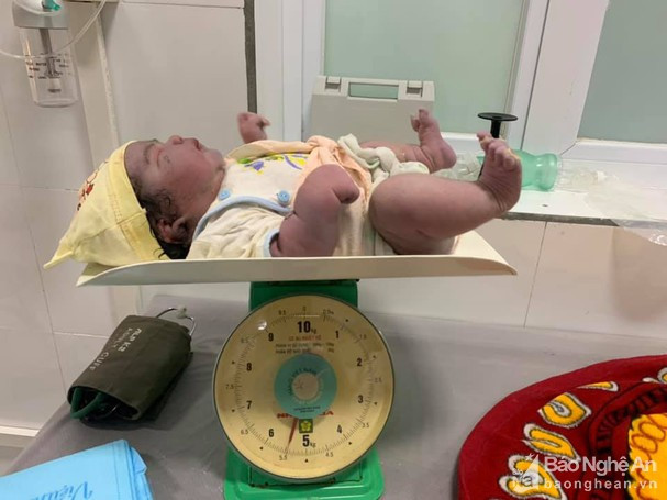 Kinh ngac,be gai nang 5,5 kg sinh thuong o Nghe An-Hinh-2