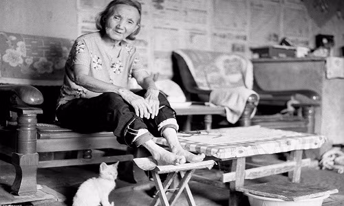 Những phụ nữ thực hiện tập tục bó chân thường gặp nhiều khó khăn trong sinh hoạt và một số vấn đề sức khỏe, đặc biệt là nguy cơ gãy xương khi bị ngã.