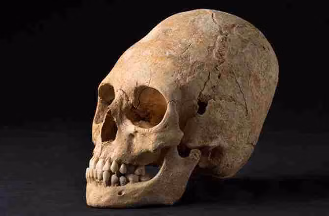 Cụ thể, người xưa quan niệm hộp sọ biến dạng thể hiện sự cao quý, vẻ đẹp hoặc mang những giá trị khác.