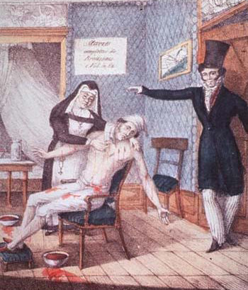 Vào thời xưa, khi khoa học công nghệ chưa phát triển, con người từng chữa bệnh giang mai bằng thủy ngân. Phương pháp chữa bệnh kỳ lạ và vô cùng nguy hiểm này được sử dụng từ khoảng năm 1363 - 1910.